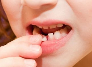 Nằm mơ rụng răng là điềm gì và đánh số nào may mắn nhất Nằm mơ rụng răng là điềm gì và đánh số nào may mắn nhất